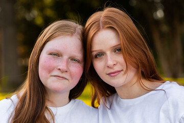Portrait of twin seventeen year old redhead girls with heads together outdoors