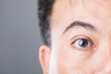 A diabetic patient's eye, symbolizing the risks of diabetic retinopathy and macular degeneration. Emphasizes the importance of eye health and monitoring for diabetes-related complications