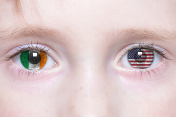 Naklejka premium human face with national flags of ireland and united states of america in the eyes.