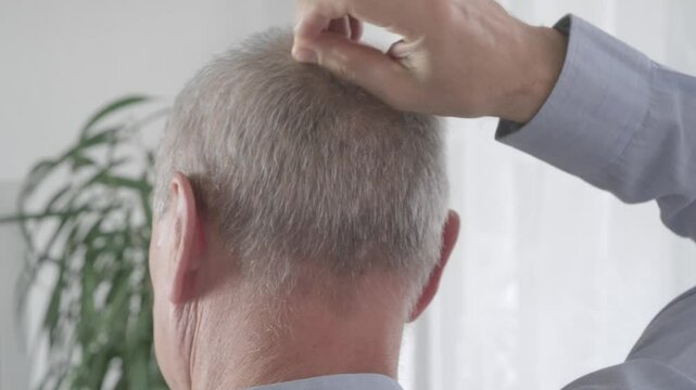 Rear view older man with bald patches on scalp, showing signs alopecia and age-related hair thinning, Anti-aging treatments for balding men, hair loss
