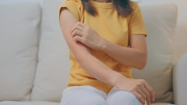 woman itching and scratching itchy arm. Sensitive Skin Allergic reaction to insect bite, food, drug dermatitis. Dermatology, Leprosy day, Systemic lupus erythematosus, Allergy symptoms and rash Eczema