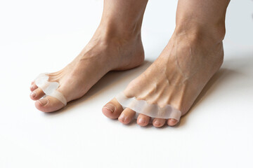 Bunion, hallux valgus. Silicone finger toe separator on feet isolated on white background. preparing for foot pedicure at home with nail separators