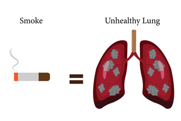 Illustration showing the harmful effects of smoking on lungs, highlighting damage and unhealthy lung condition caused by smoking. eps 10