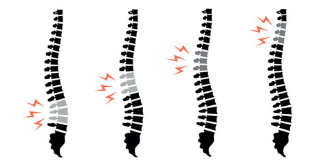 Illustrations of spine icons with highlighted areas indicating back pain. Medical symbols for spine health and injury.