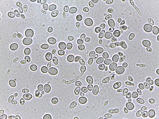 Microscopic view of yeast cells