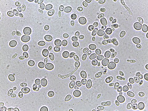 Microscopic view of yeast cells