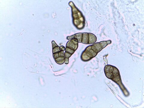 Microscopic view of Alternaria spores.
