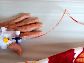 Elderly woman's hand with Saline IV and blood in an infusion set isolated on white bed sheet.