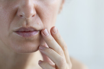 Woman with problem skin. Big pores, hair and wrinkles on the face.