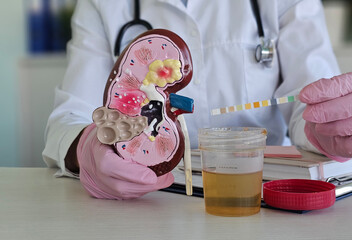 A doctor performing a test with a urine sample and a kidney model concept