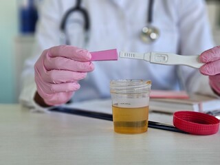 Medical scientist holding PH test with urine sample concept