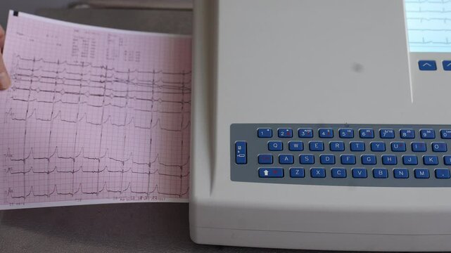 Female hand holding an electrocardiogram ECG printout while it is being printed by a modern ECG machine, showcasing medical diagnostics and heart health monitoring. Concept of cardiology
