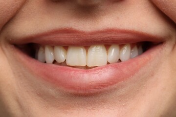 Woman smiling with her teeth, closeup view