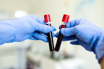 Hands of a doctor or nurse in blue medical gloves hold test tubes with blood. Blood sampling in the...