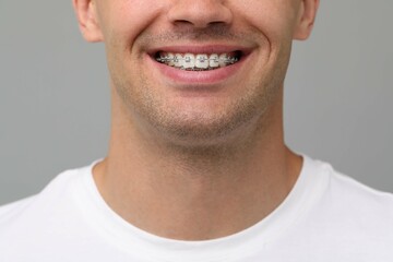 Obraz premium Smiling man with dental braces on grey background, closeup