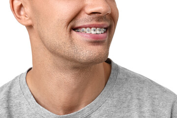 Fototapeta premium Smiling man with dental braces on white background, closeup