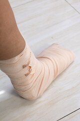 broken toe and  wearing a cast on  foot