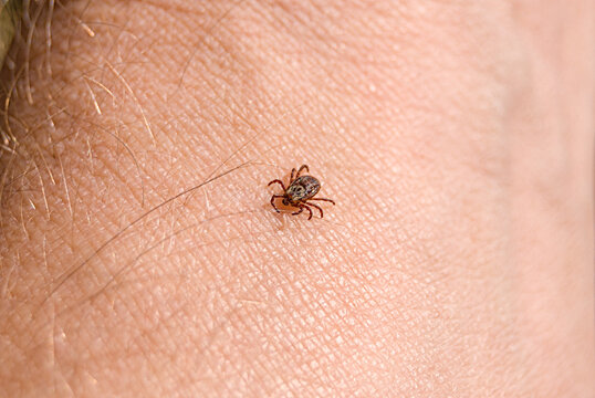 The tick Ixodes ricinus crawling on human skin. Encephalitis tick. This kind of animal is a distributor of borrelia