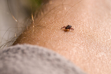 The tick Ixodes ricinus crawling on human skin. Encephalitis tick. This kind of animal is a distributor of borrelia