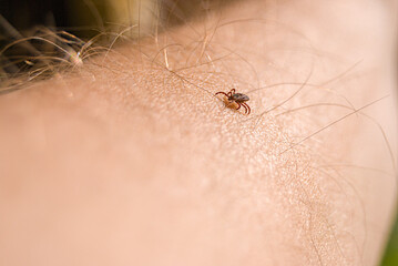 The tick Ixodes ricinus crawling on human skin. Encephalitis tick. This kind of animal is a distributor of borrelia