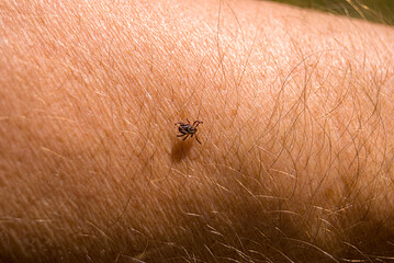 The tick Ixodes ricinus crawling on human skin. Encephalitis tick. This kind of animal is a distributor of borrelia