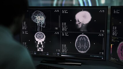 Doctor monitoring the x-ray analysis of the ill persons head. Doctor controlling the x-ray analysis procedure at the healthcare clinic. Doctor diagnosing the brain damage after an x-ray analysis. - Powered by Adobe