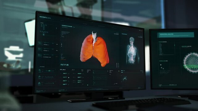 Examination of the patient at the laboratory before the difficult surgery. Examination of the organs at the laboratory preparing for surgery. Laboratory examination detected lung cancer before surgery