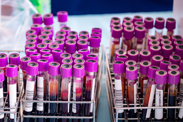 Close up blood sample tubes of a blood donor, sample tubes for collecting patient's blood for...