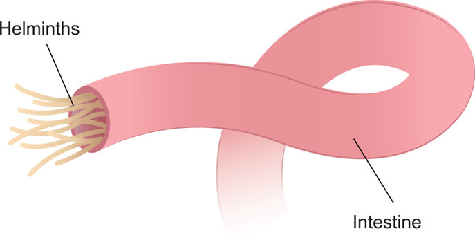 Illustration of internal human parasites, roundworm or hookworm in the small intestine
