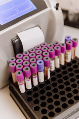 Close up of blood sample tubes in a lab rack, ready for analysis and diagnostics