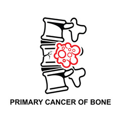 Bone cancer icon. Primary cancer of bone isolated on background vector illustration.