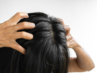 Obraz premium Dandruff Itchy scalp, woman chtatch hair messy she dirty, sensitive disease bacteria dander loss, concept for medicine hyginene champoo treatment skin for good health.