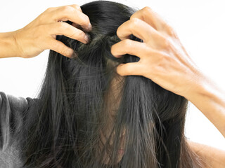 Dandruff Itchy scalp, woman chtatch hair messy she dirty, sensitive disease bacteria dander loss, concept for medicine hyginene champoo treatment skin for good health.