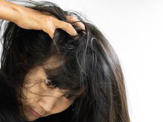 Fototapeta premium Dandruff Itchy scalp, woman chtatch hair messy she dirty, sensitive disease bacteria dander loss, concept for medicine hyginene champoo treatment skin for good health.