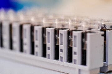 Lab cassettes with samples for research. Various laboratory cassettes hold samples prepared for analysis in a research facility during a study.