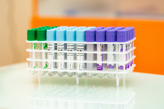 Test tubes arranged by color and function in a lab. Various test tubes in different colors are organized on a rack, ready for laboratory analysis in a medical facility.