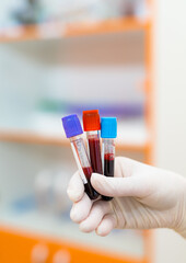 Blood sample tubes in lab. A gloved hand is holding three test tubes containing blood samples in a...