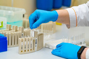 Scientist experimenting in lab. A scientist in blue gloves carefully places a test tube into a rack, focusing on laboratory procedures and accuracy.