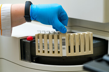 Lab technician processing samples in a centrifuge. A lab technician in blue gloves loads test tubes into a centrifuge for processing at a laboratory.