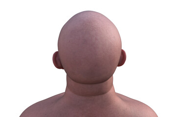 A man's hairless head from back top view, 3D illustration