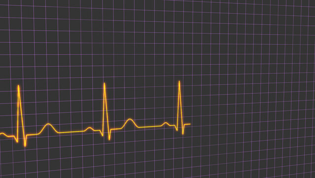 Normal heart rhythm ECG electrocardiogram of a healthy person, heart examination method