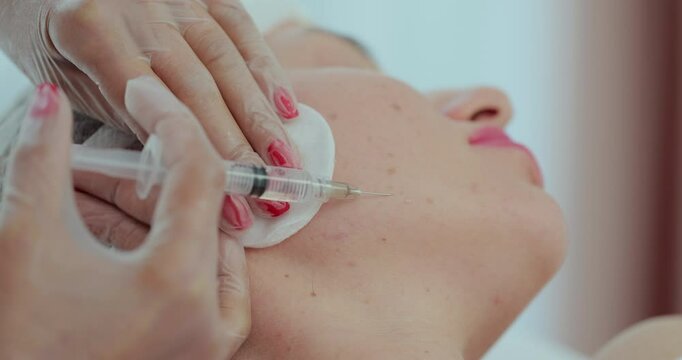 Cosmetologist doctor is making multiple injections biorevitalization with hyaluronic acid in woman face skin on cheek, closeup. Beautician on mesotherapy and face lifting procedure in beauty clinic.