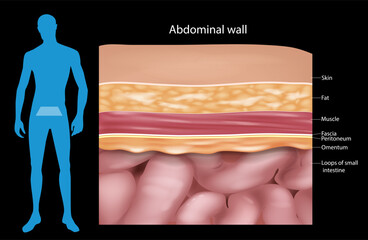 Abdominal wall Layers, muscles and fascia. Cross-section Anatomy  Abdominal wall. Medical Illustration