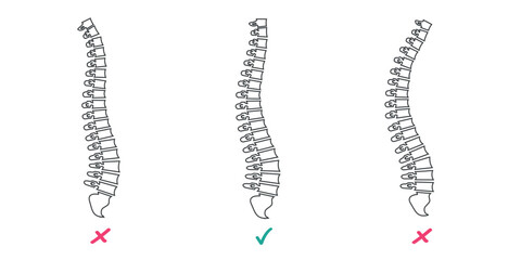 Illustration of spinal columns showing correct and incorrect postures.