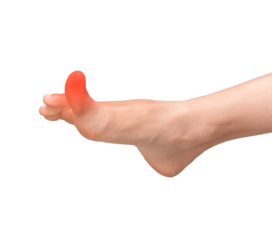 foot with a painful, inflamed big toe, isolated on a white background. Medical concept showing symptoms of arthritis, injury, or swelling. Perfect for healthcare, orthopedics, or