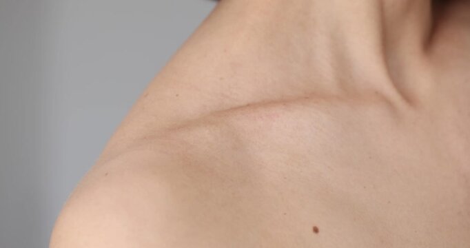 Posture corrector exercises for shoulders and back