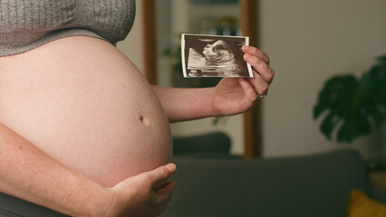 Pregnant Woman Holding Ultrasound Image of Unborn Baby, Showcasing Maternity, Expectation, and New...