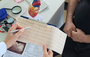 Doctor hands pointing Electro-cardiogram chart on clipboard pad fill medical history with pen