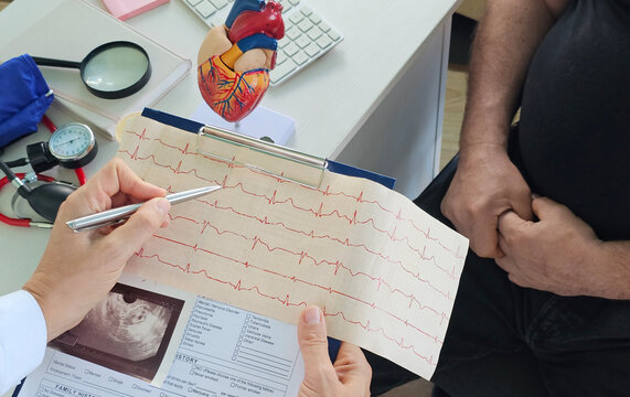 Doctor hands pointing Electro-cardiogram chart on clipboard pad fill medical history with pen
