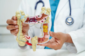 Intestine, doctor holding human anatomy model for study diagnosis and treatment in hospital.